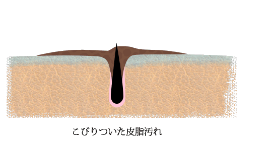 母の滴シルバーウォッシュジェルの洗浄力