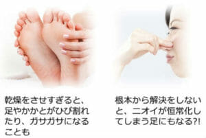 ティノンの効果