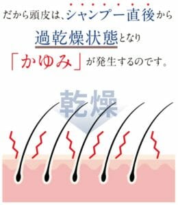頭皮が乾燥